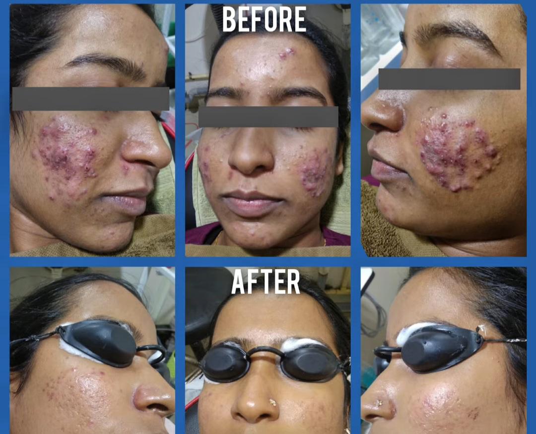 Advanced Skin Treatment